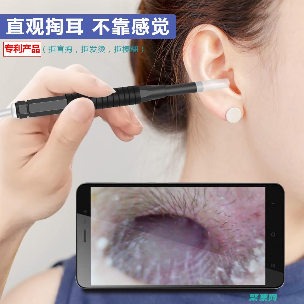 高清可视耳镜怎么连接华为mt9手机