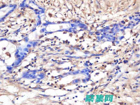 探索Jenkins强大的持续集成和持续交付功能