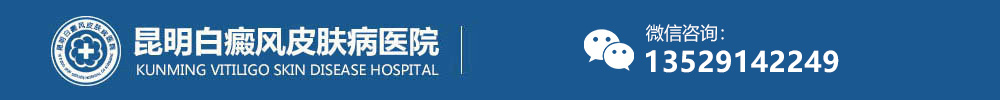 昆明白癜风医院-昆明白癜风医院哪家好|治疗费用-昆明白癜风专科医院