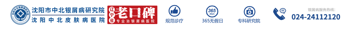 「沈阳中北牛皮癣医院」-沈阳牛皮癣专科医院-沈阳银屑病医院哪个正规-沈阳看效果好的银屑病